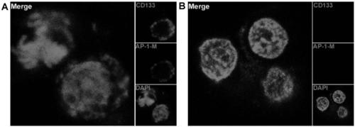Drug conjugate of nucleic acid aptamer in targeted combination with CD133 protein and application of drug conjugate