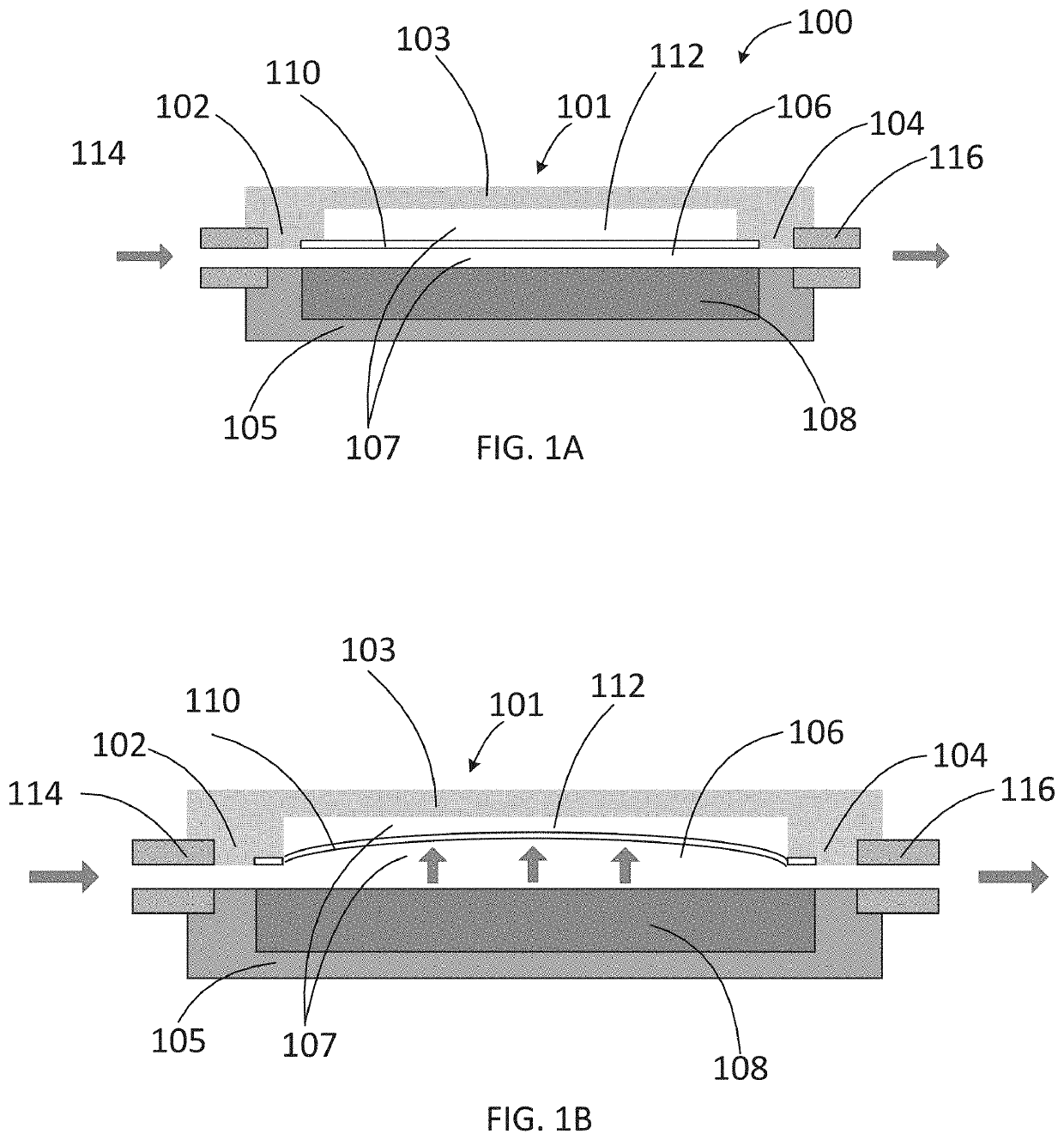 Apparatus for treating excess intraocular fluid having an elastic membrane