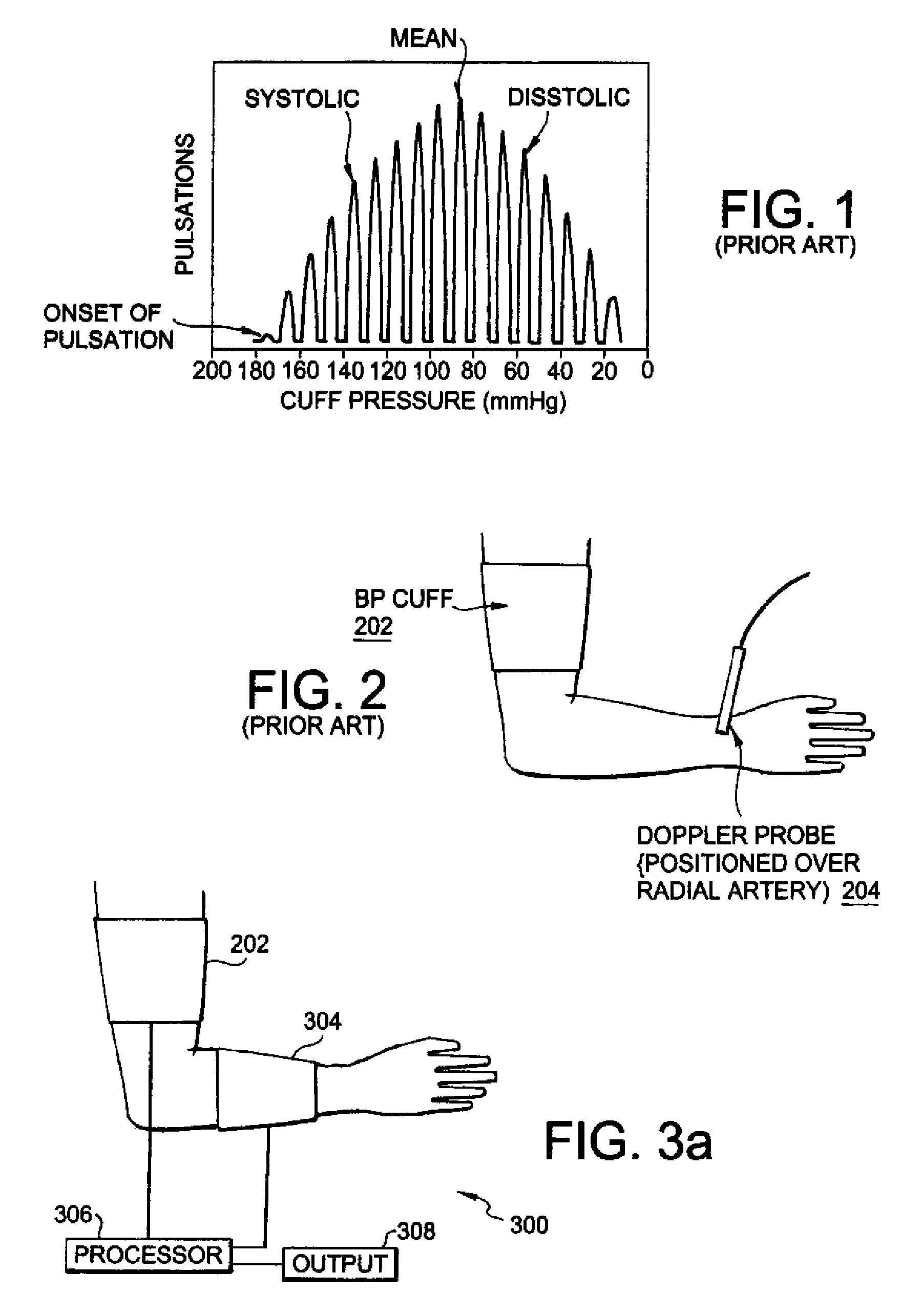 Impedance based device for non-invasive measurement of blood pressure and ankle-brachial index