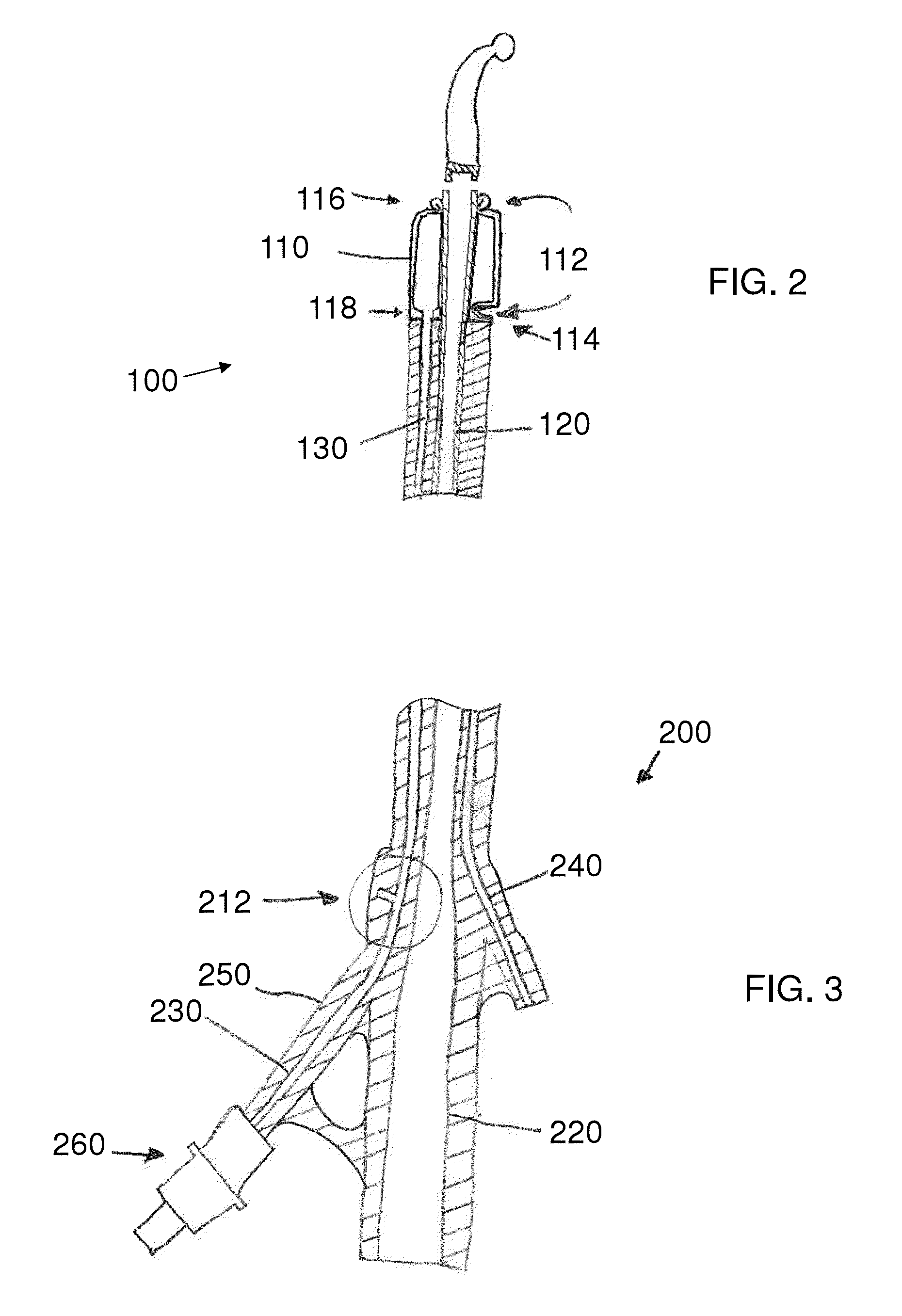Stretch valve balloon catheter and methods for producing and using same