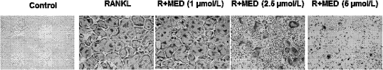 Application of epoxidized diene as osteoclast differentiation inhibitor