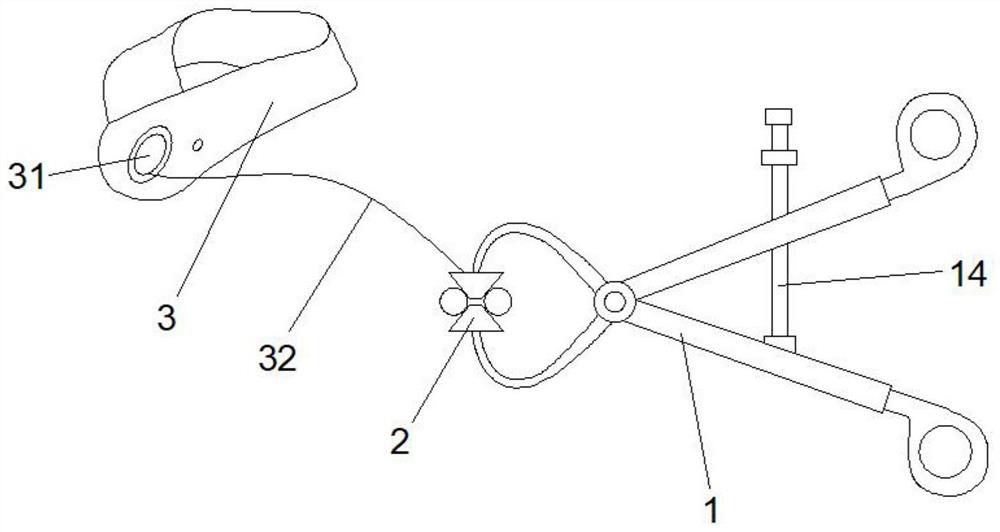 Noninvasive adjustable extrusion type skin expansion device for symphysodactylia of children