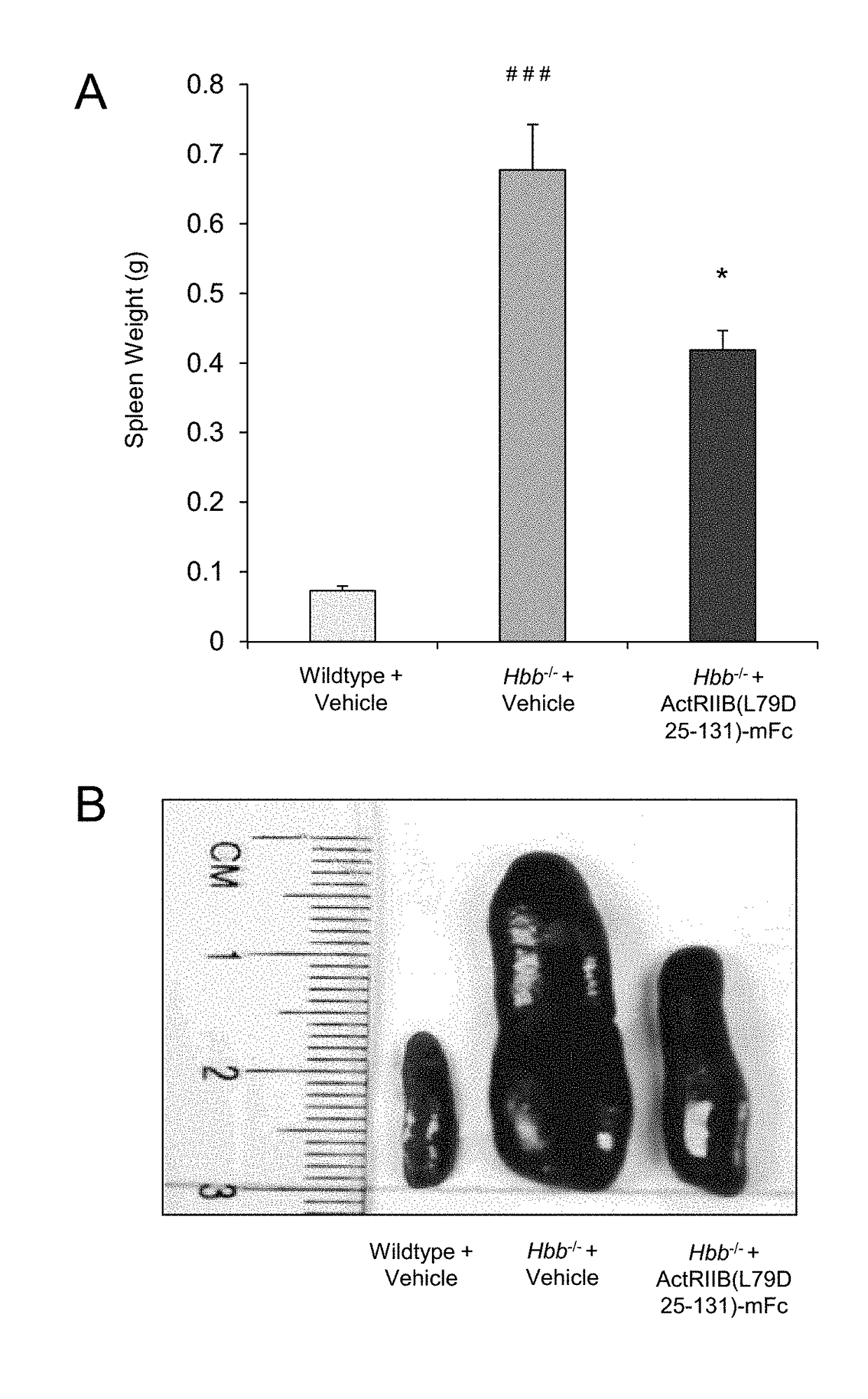 Methods and compositions for treating ineffective erythropoiesis