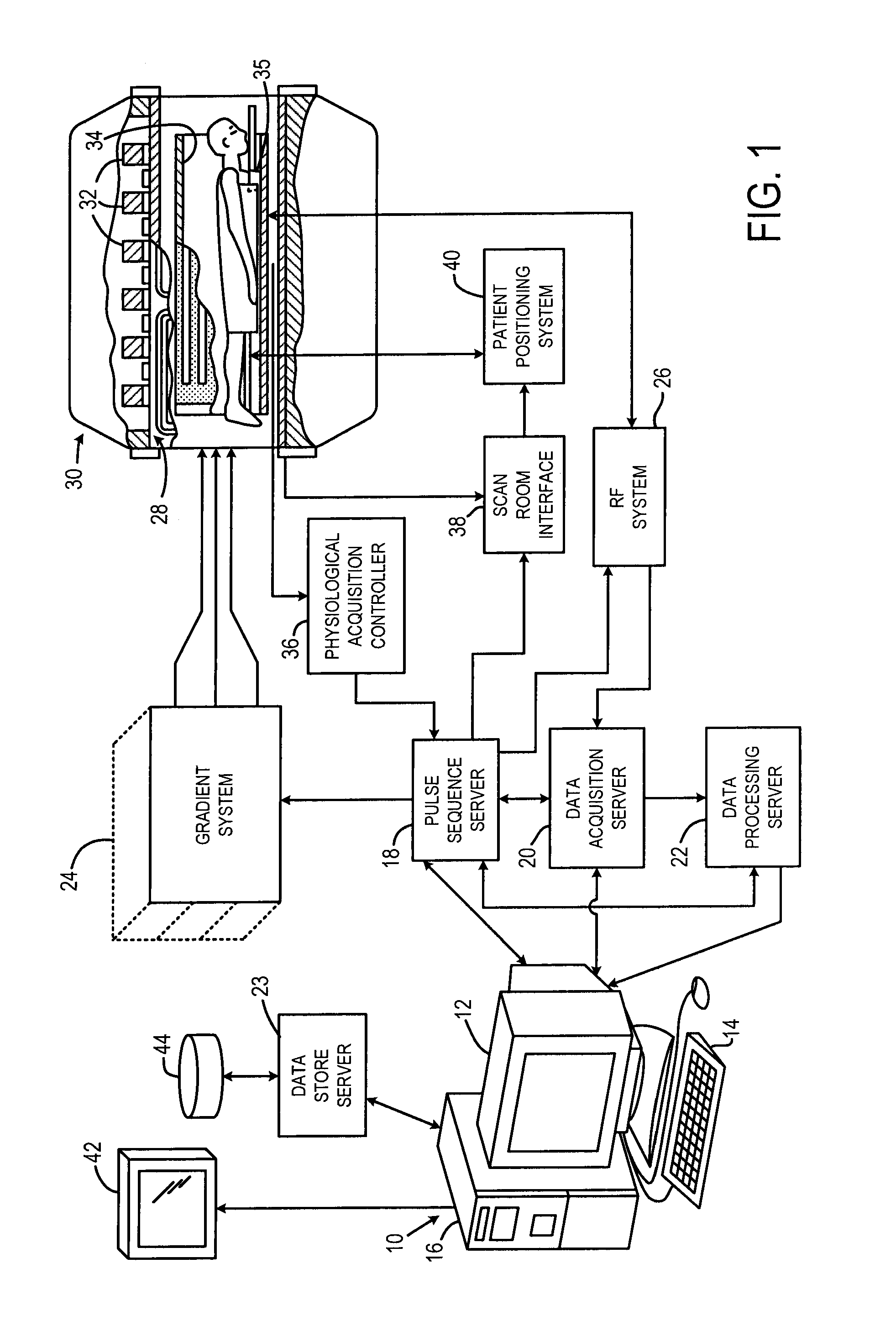 Local MRI breast coil and method of use