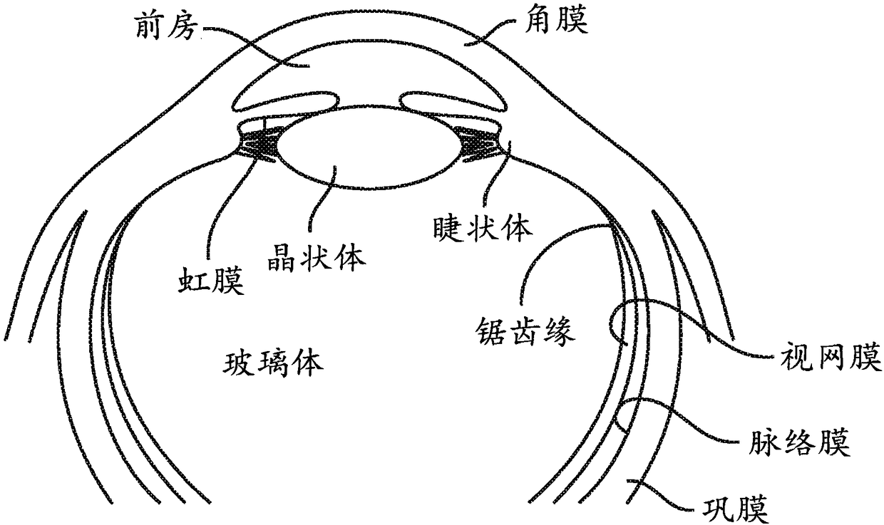 Ultrasound directed cavitational methods and system for ocular treatments