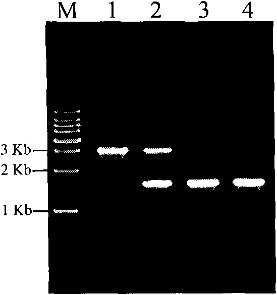 A kind of β-ketothiolase related to the 3-hv monomer synthesis of phbv, its coding gene and application