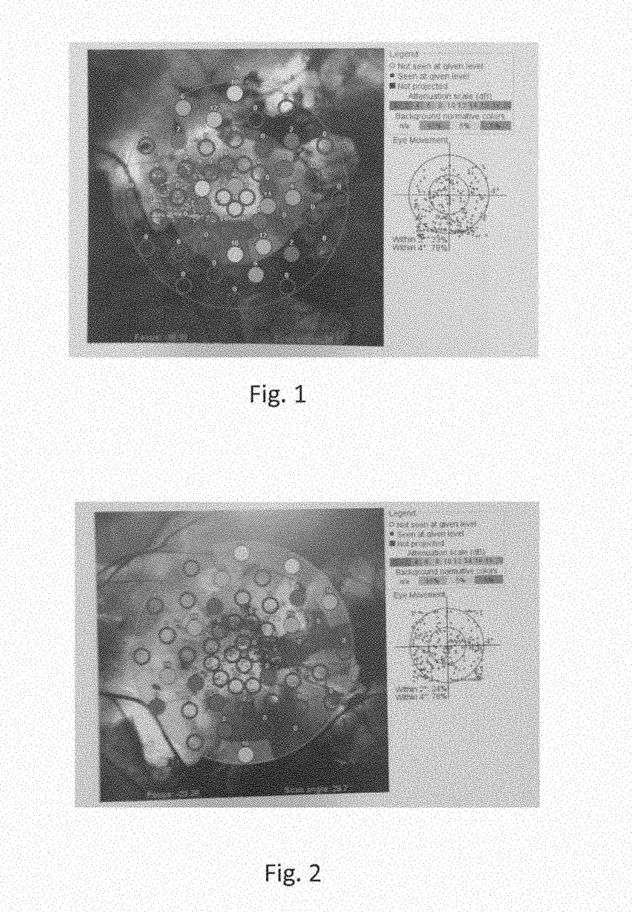 Manganese superoxide dismutase variants and uses thereof