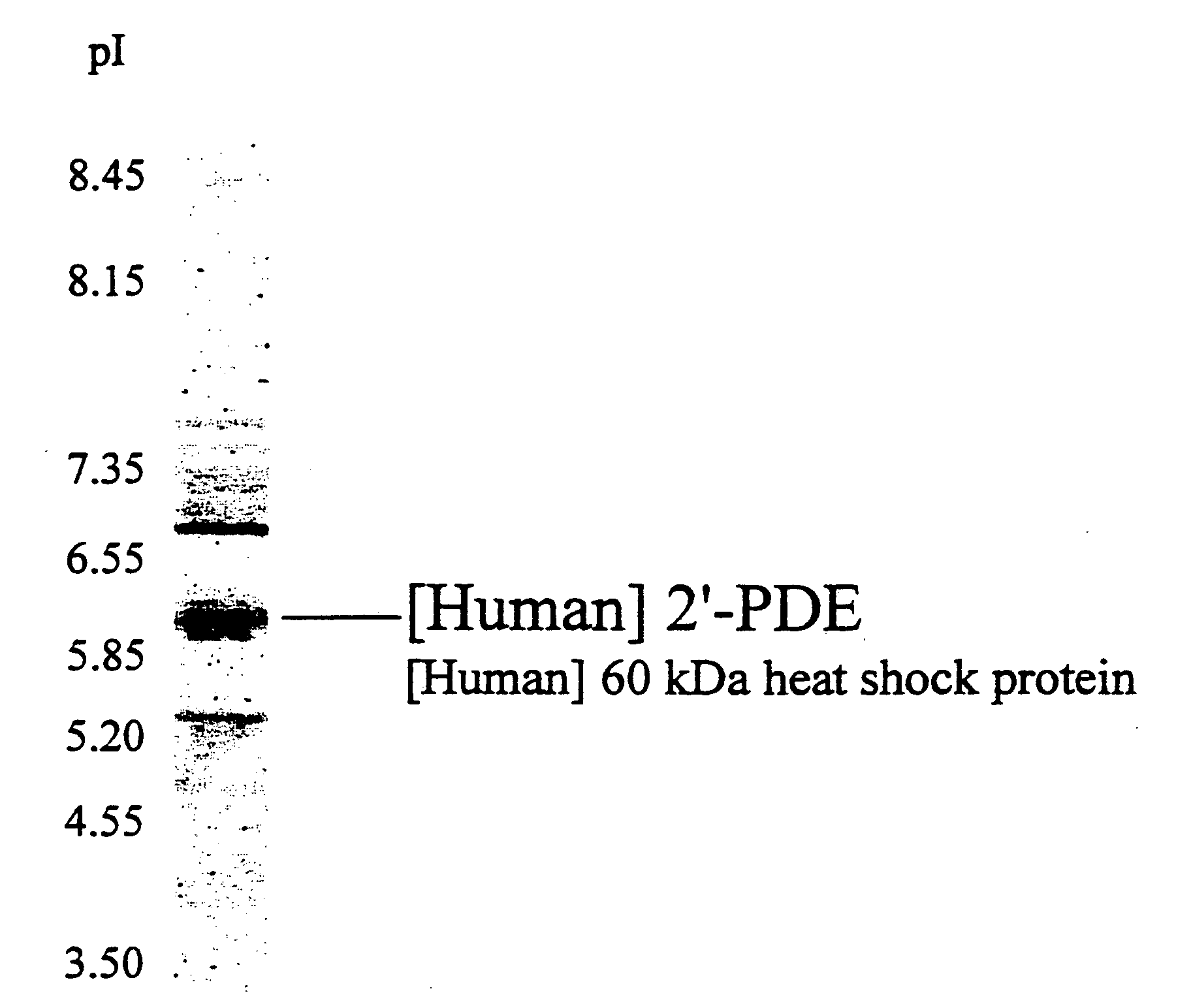 2', 5'-oligoadenylate phosphodiesterase