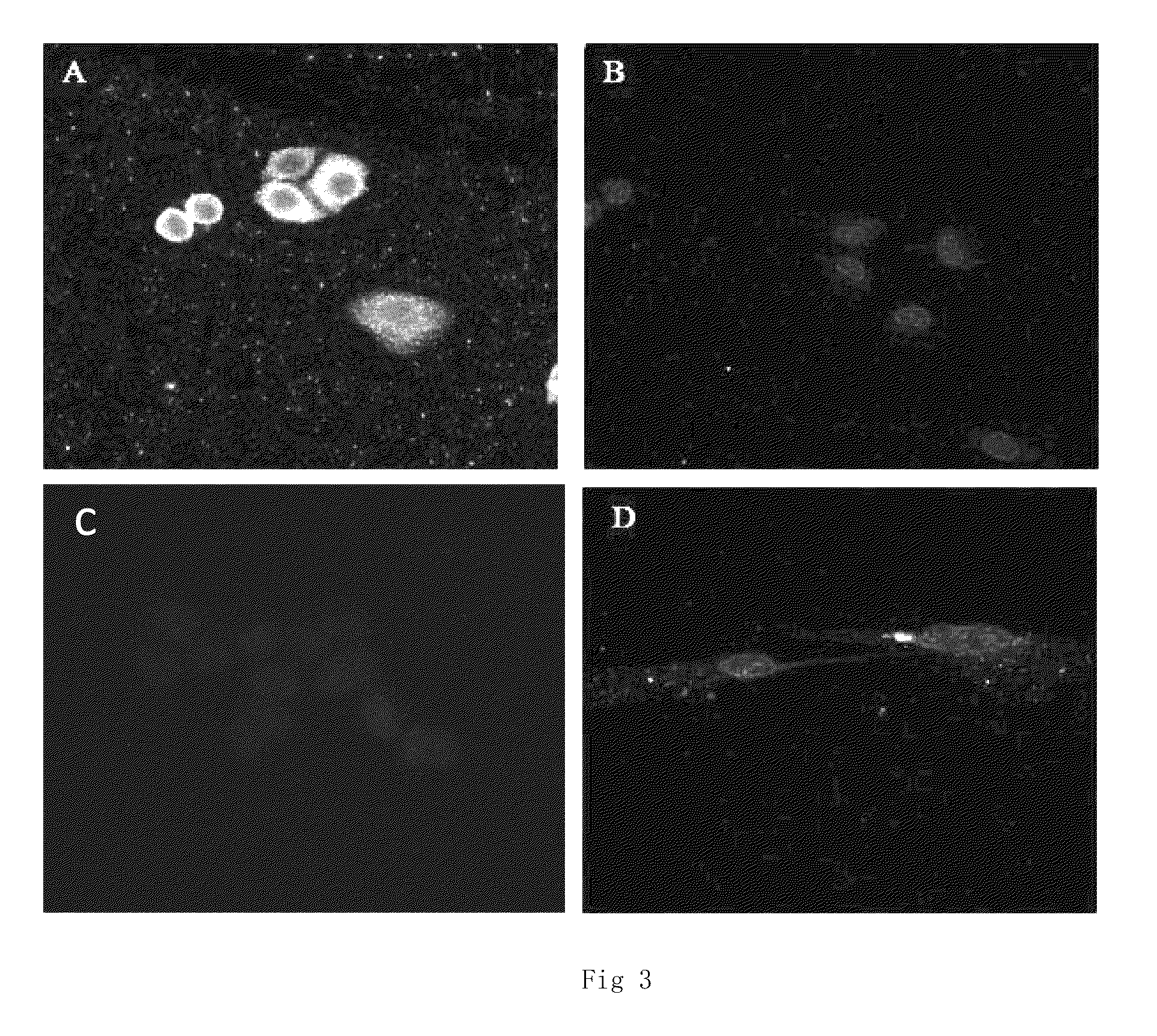 Monoclonal antibody against human non-small cell lung carcinoma and use thereof
