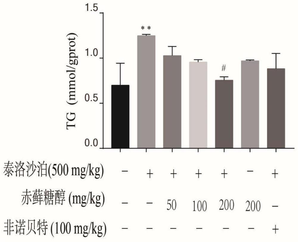 Application of erythritol in preparation of medicine for treating non-alcoholic fatty liver
