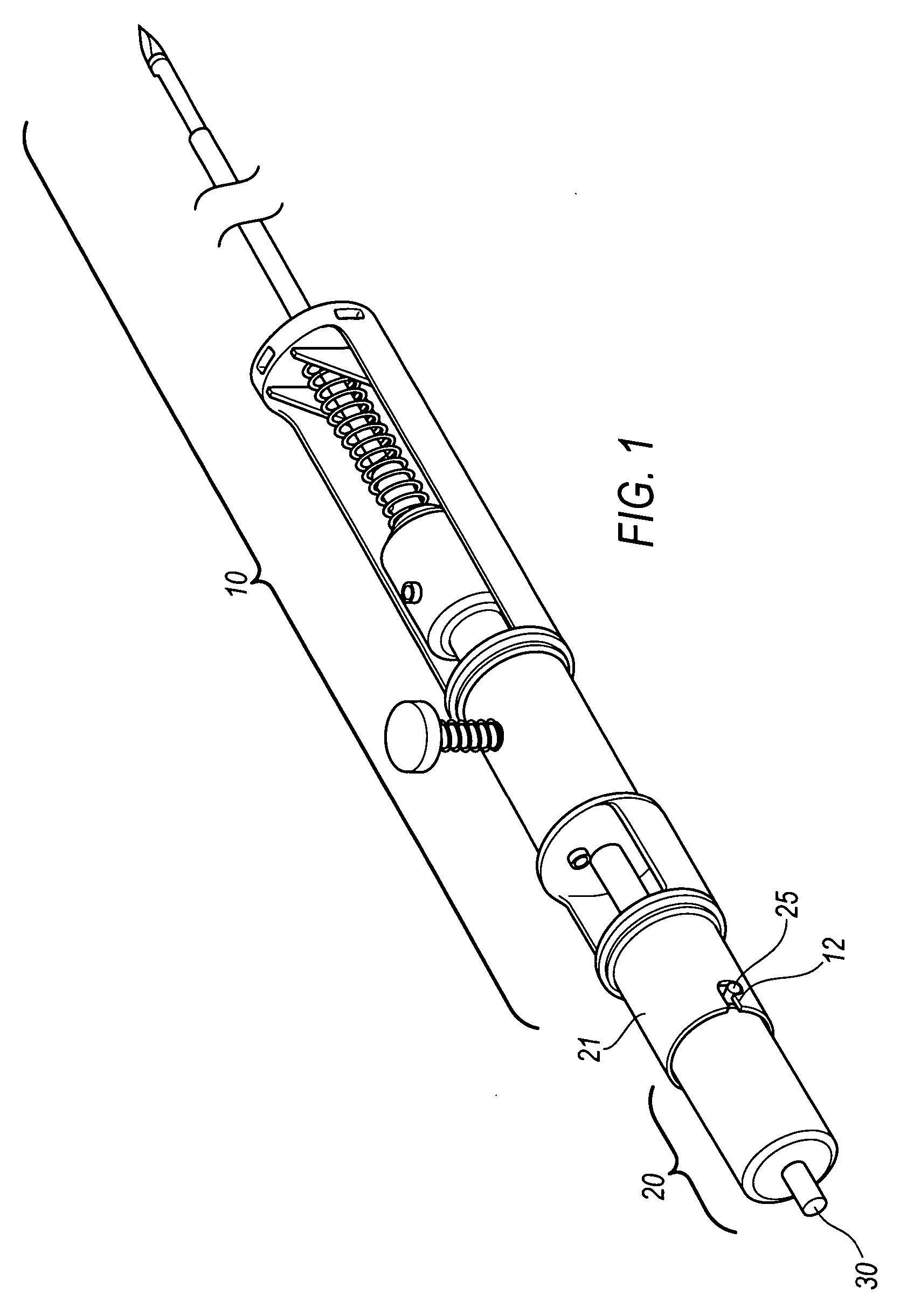 Selectively openable tissue filter