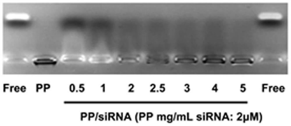 Preparation method of bionic siRNA nano complex with anticancer activity