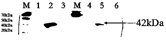 Non-resistance screening double antigen anchor expression vector plq2a and its preparation method