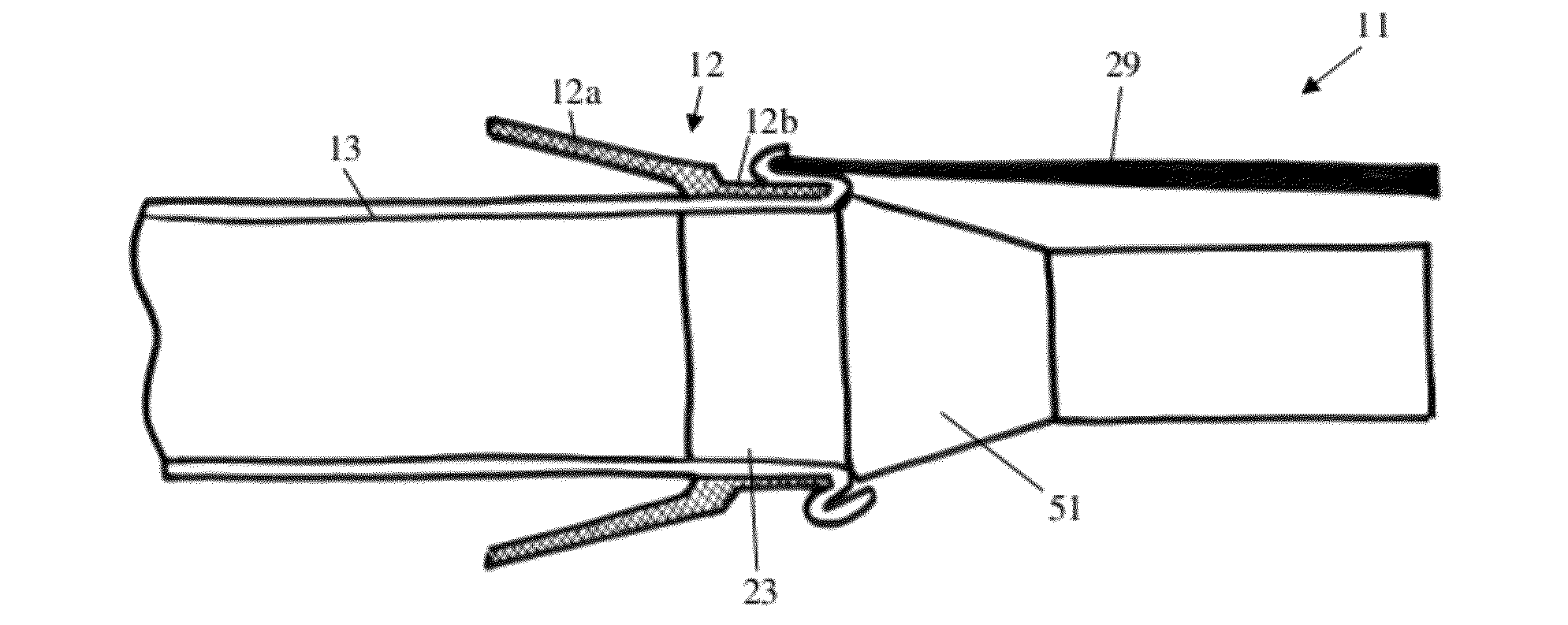 Device for preparing tissue for anastomosis