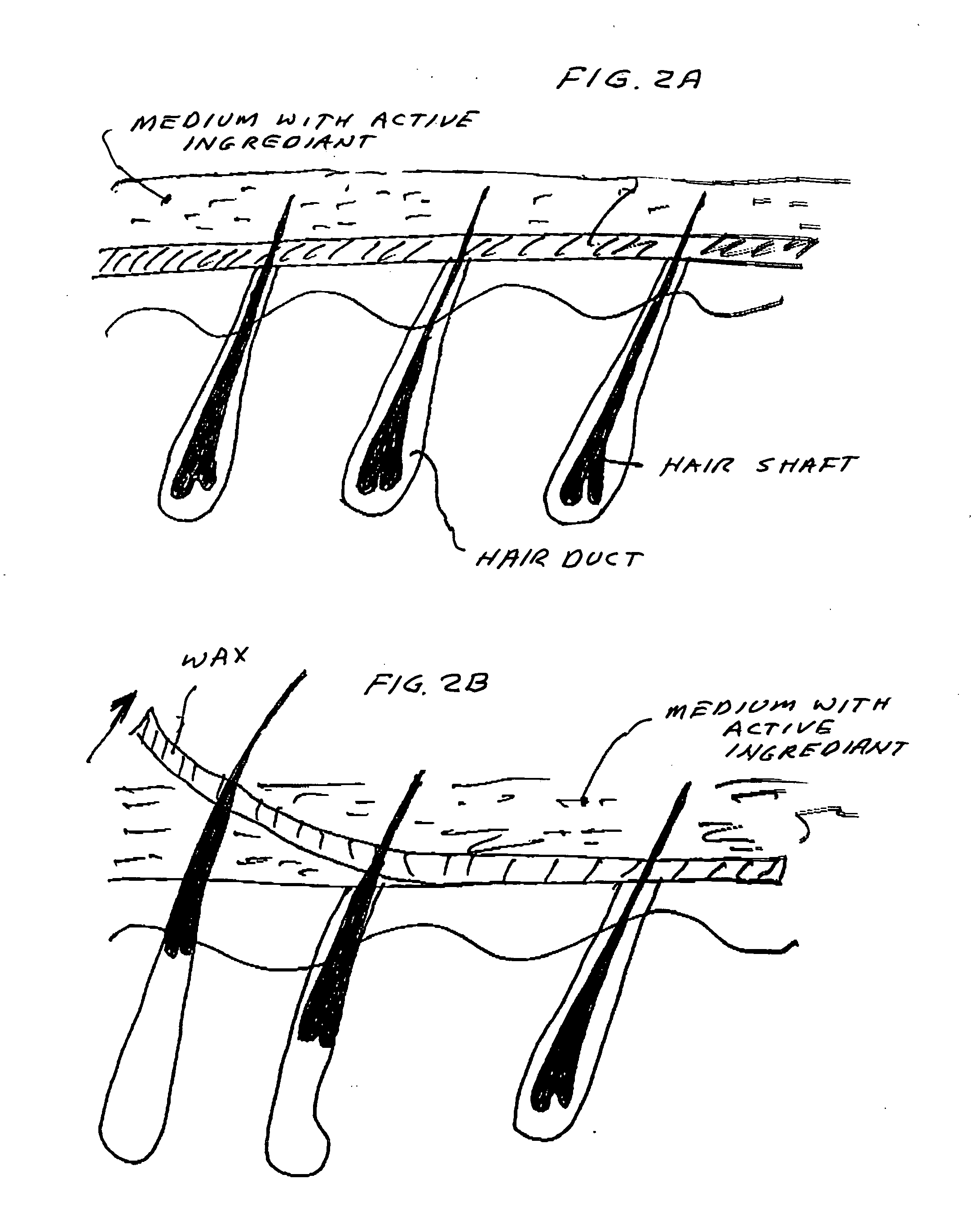 Vaccine for hair removal