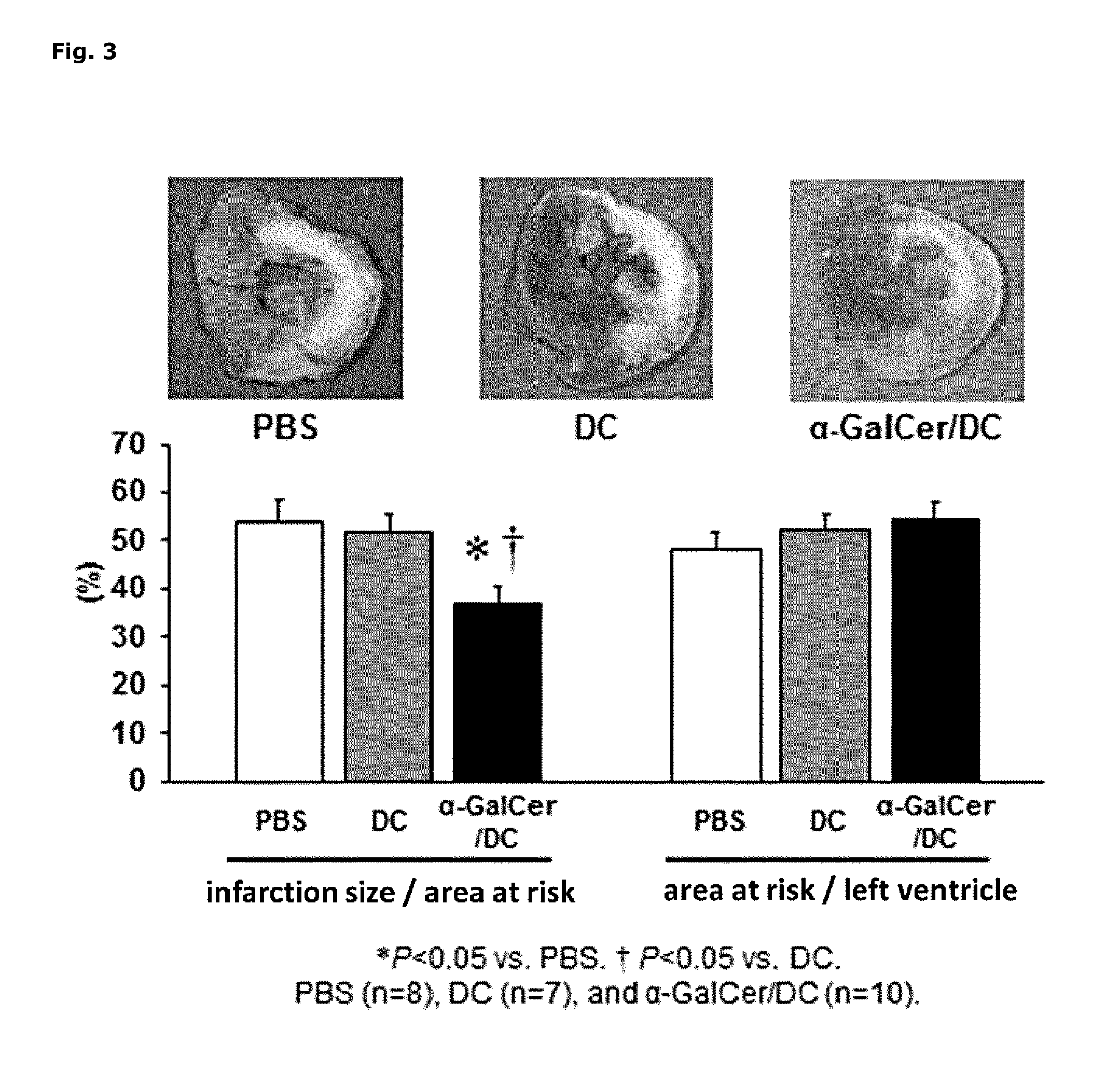 Pharmaceutical containing dendritic cells, and method for producing same