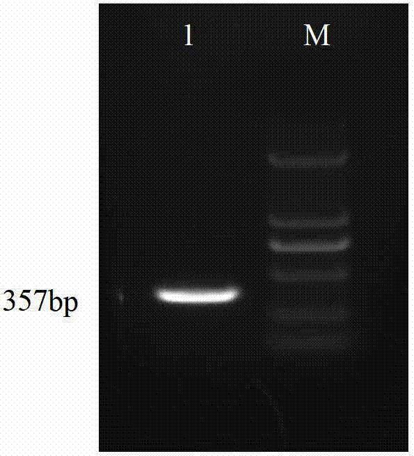 Monoclonal antibody of anti-perkinsus membrane protein, preparation method and application thereof