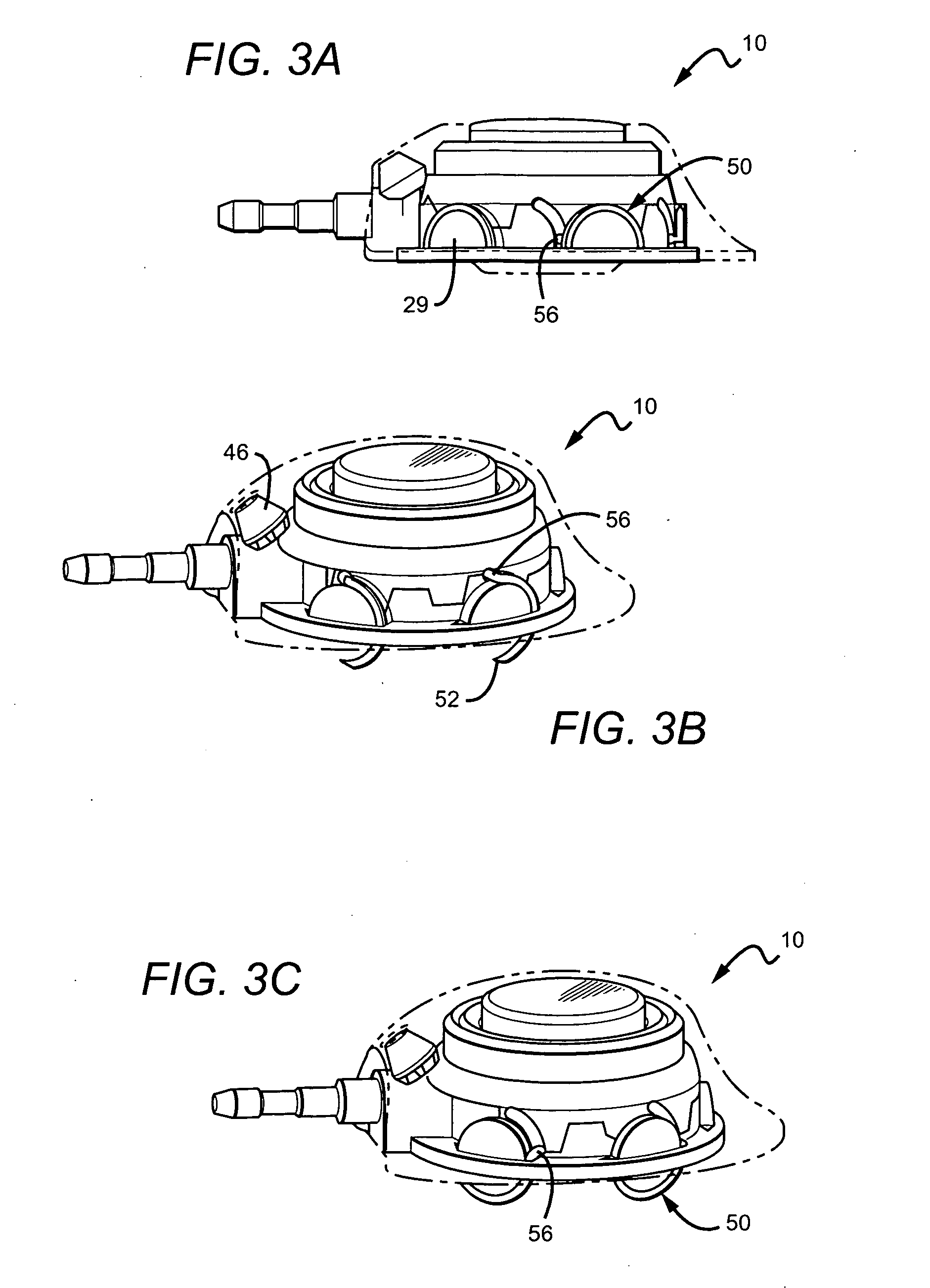 Vascular access port with integral attachment mechanism