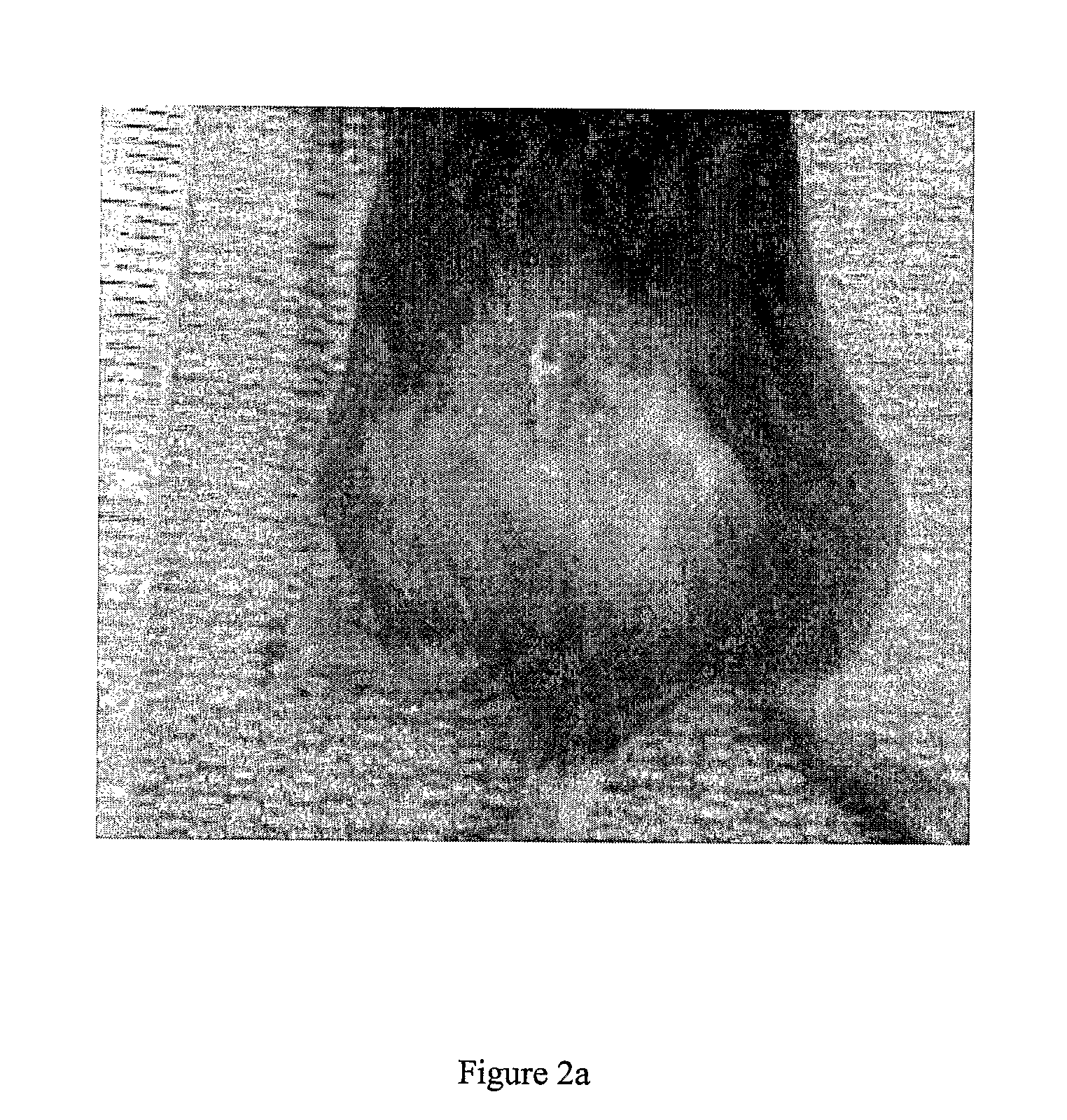 Compositions and uses thereof for the treatment of wounds