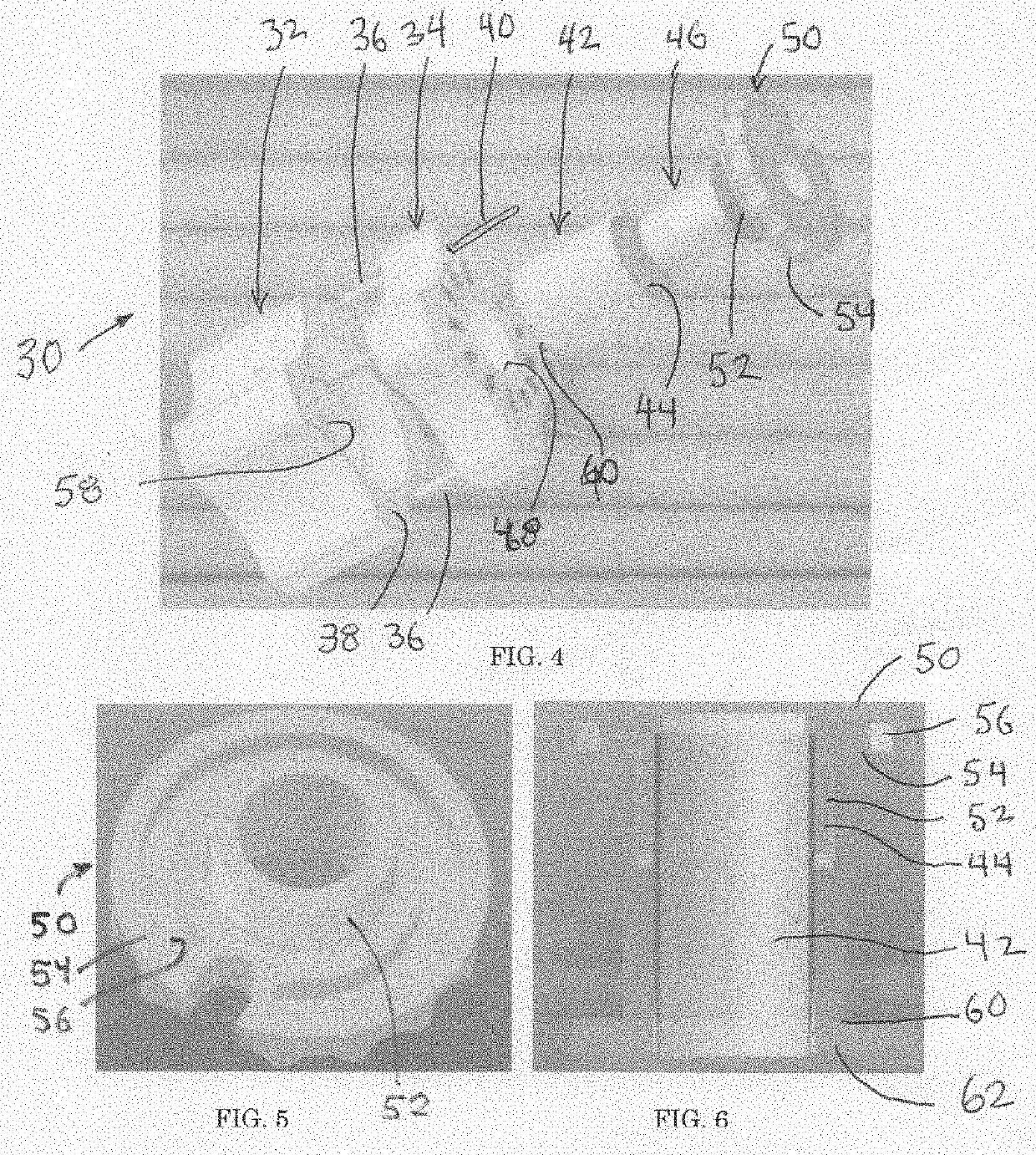 Limited depth corneal punch