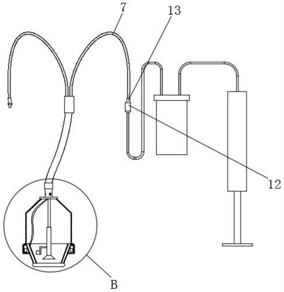 A device for removing stones in clinical hepatobiliary surgery