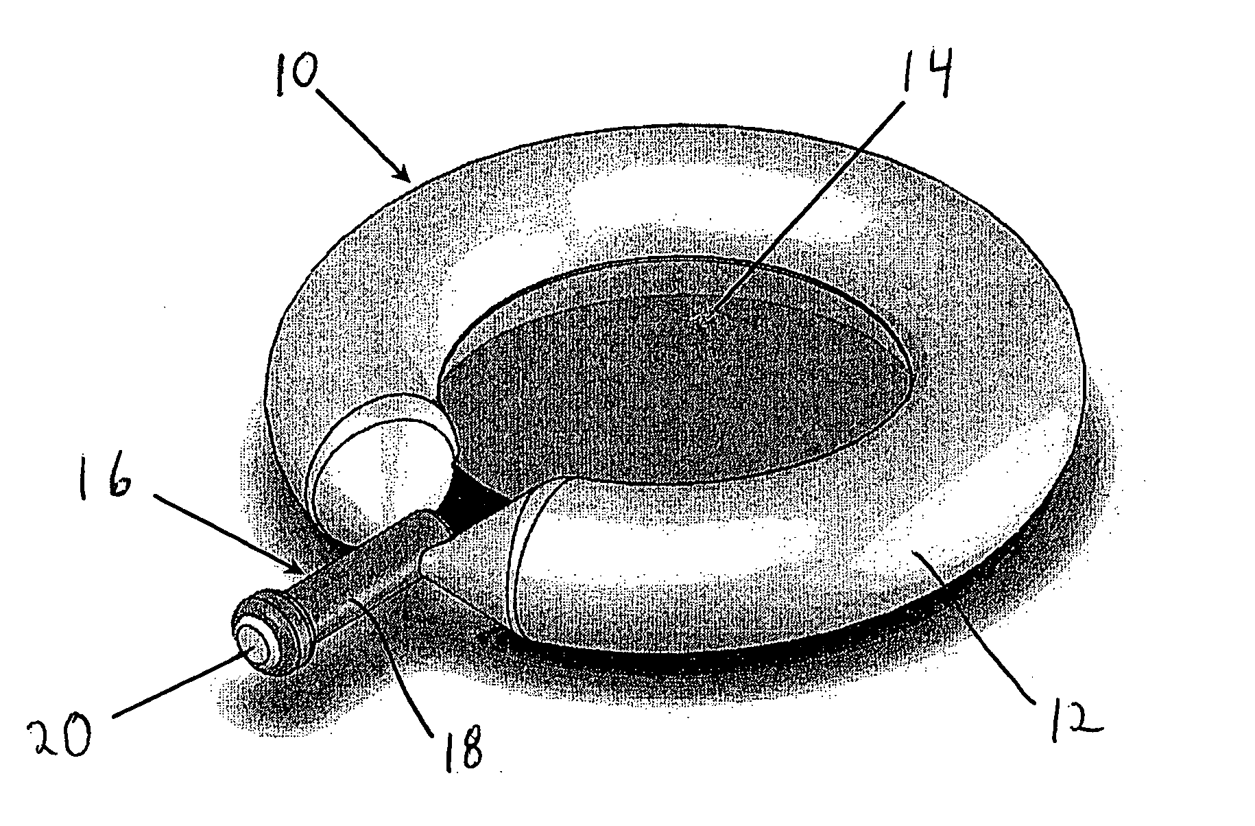 Anatomical spacer and method to deploy
