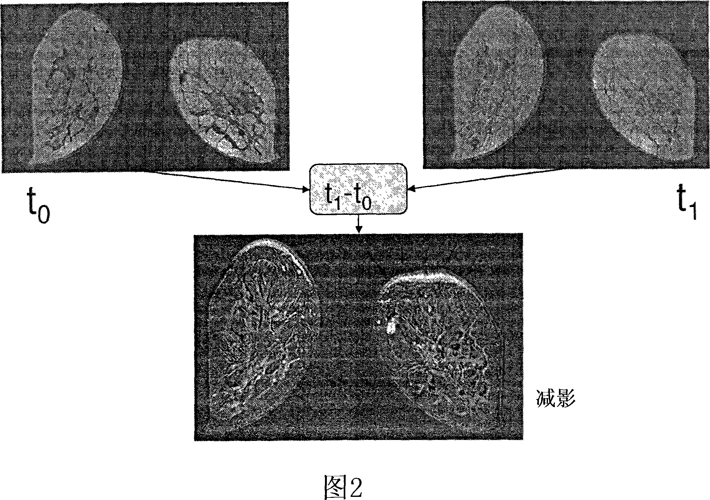 Method and computer program product for registering biomedical images with reduced imaging arefacts caused by object movement