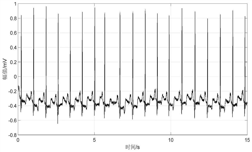 Method, system and device and medium for detecting starting point and ending point of electrocardiogram feature