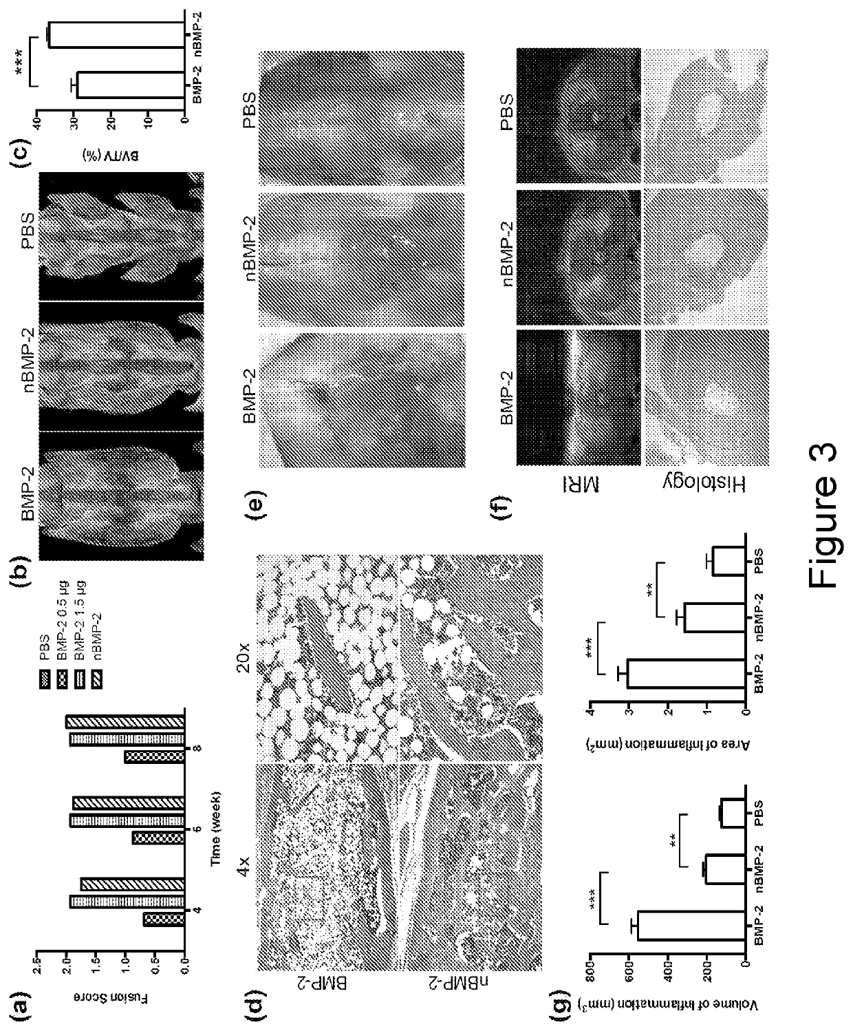 Growth-factor nanocapsules with tunable release capability for bone regeneration