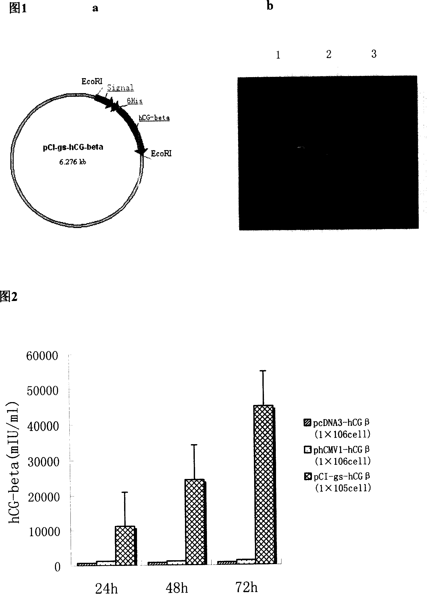 Method for preparing human chorion gonadotrophic hormone beta subunit