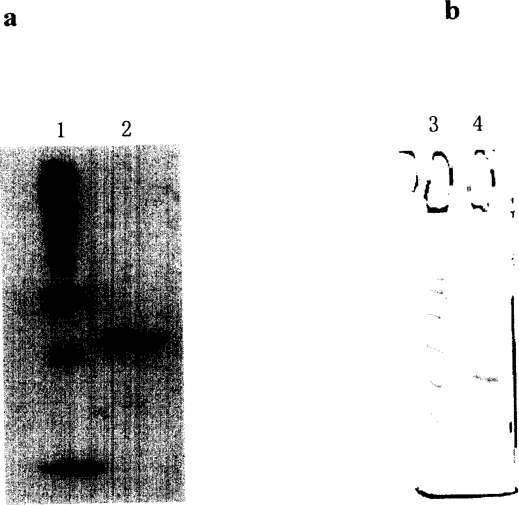 Method for preparing human chorion gonadotrophic hormone beta subunit