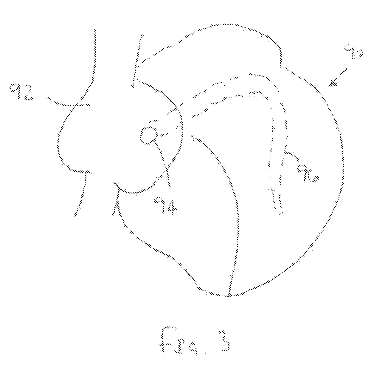 Apparatus and methods for delivering transvenous leads