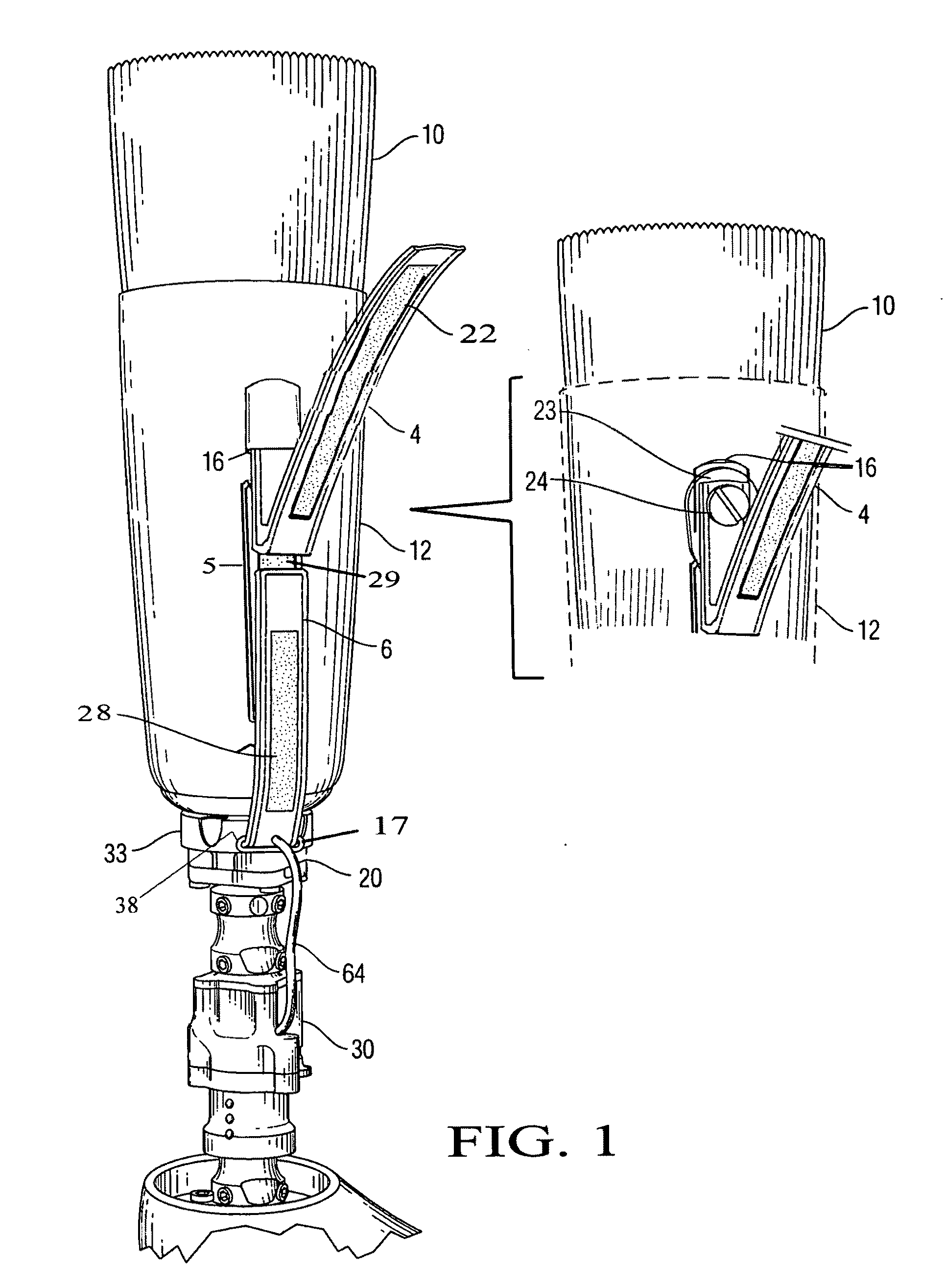 Prosthetic attachment system with low profile attachment pad