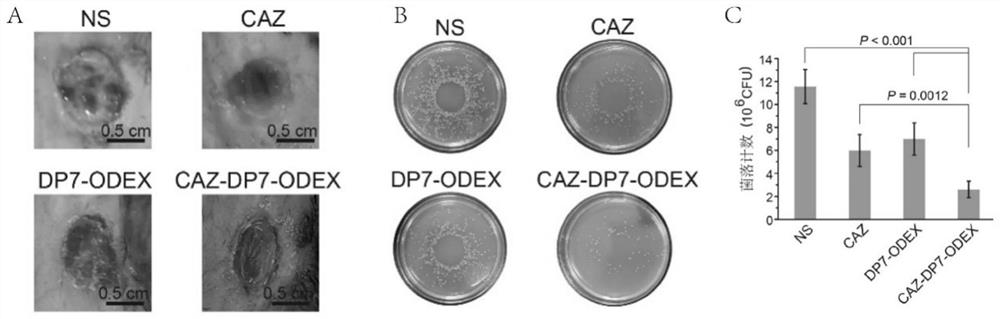 New application of polypeptide, antibacterial gel material and local drug delivery system