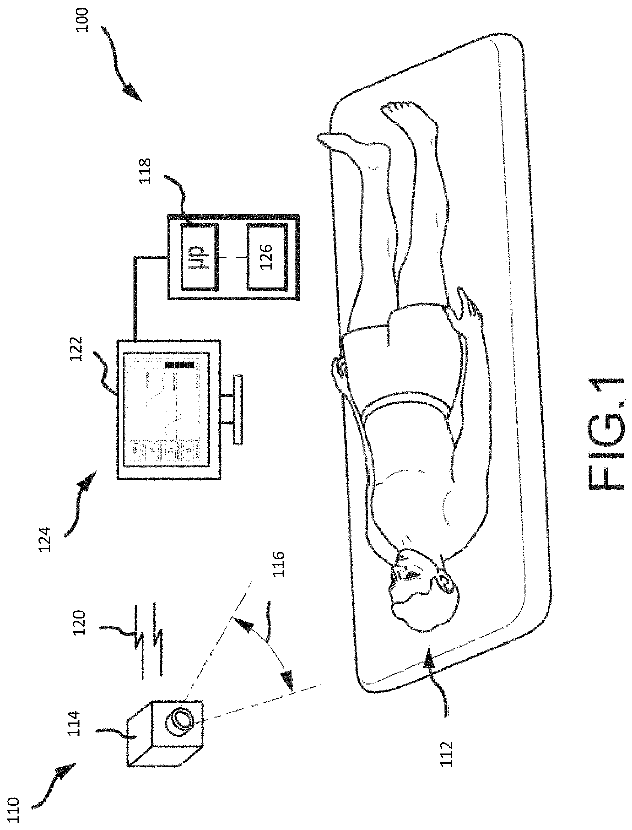 Systems and methods for sedation-level monitoring