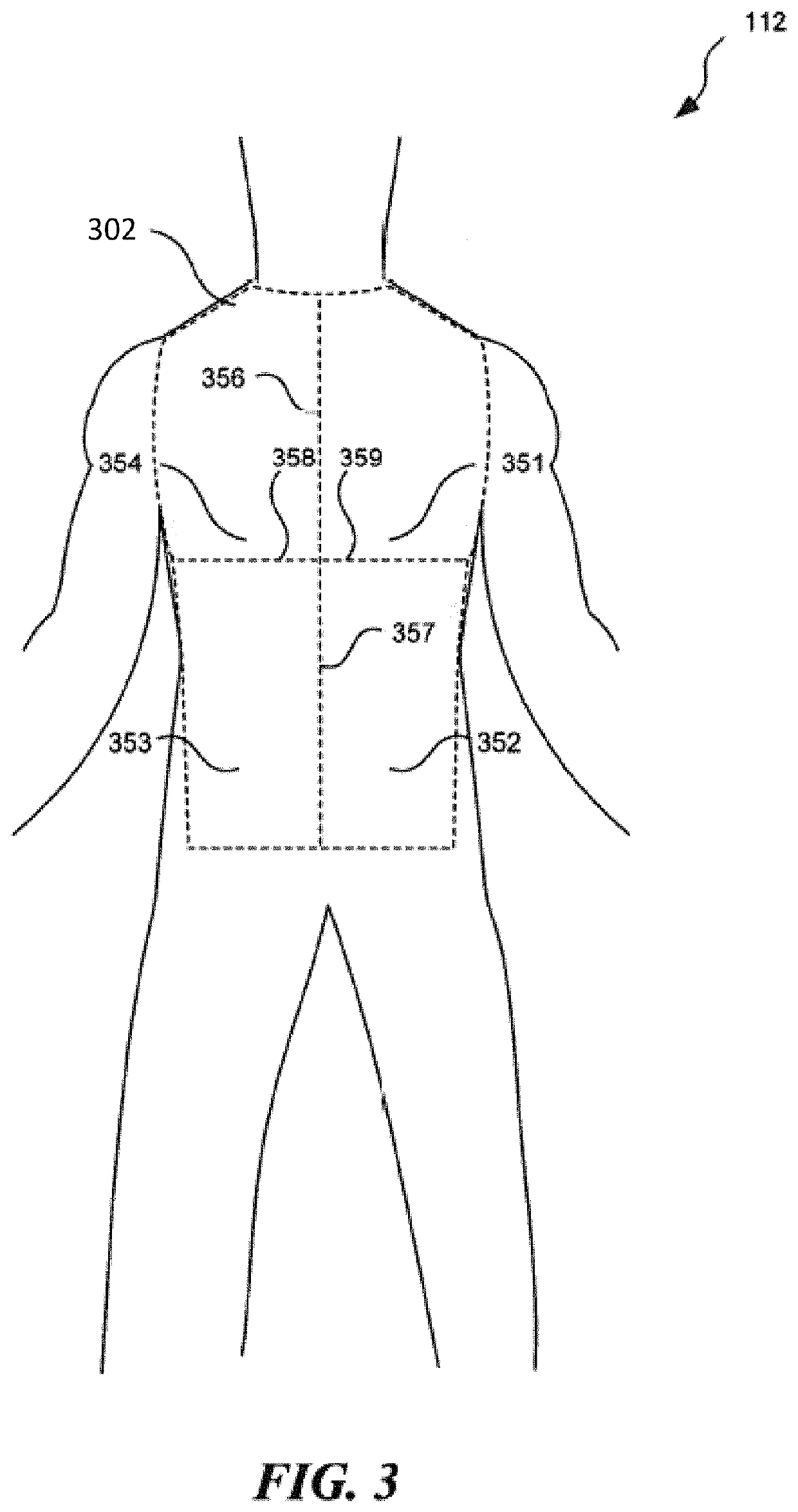 Systems and methods for sedation-level monitoring