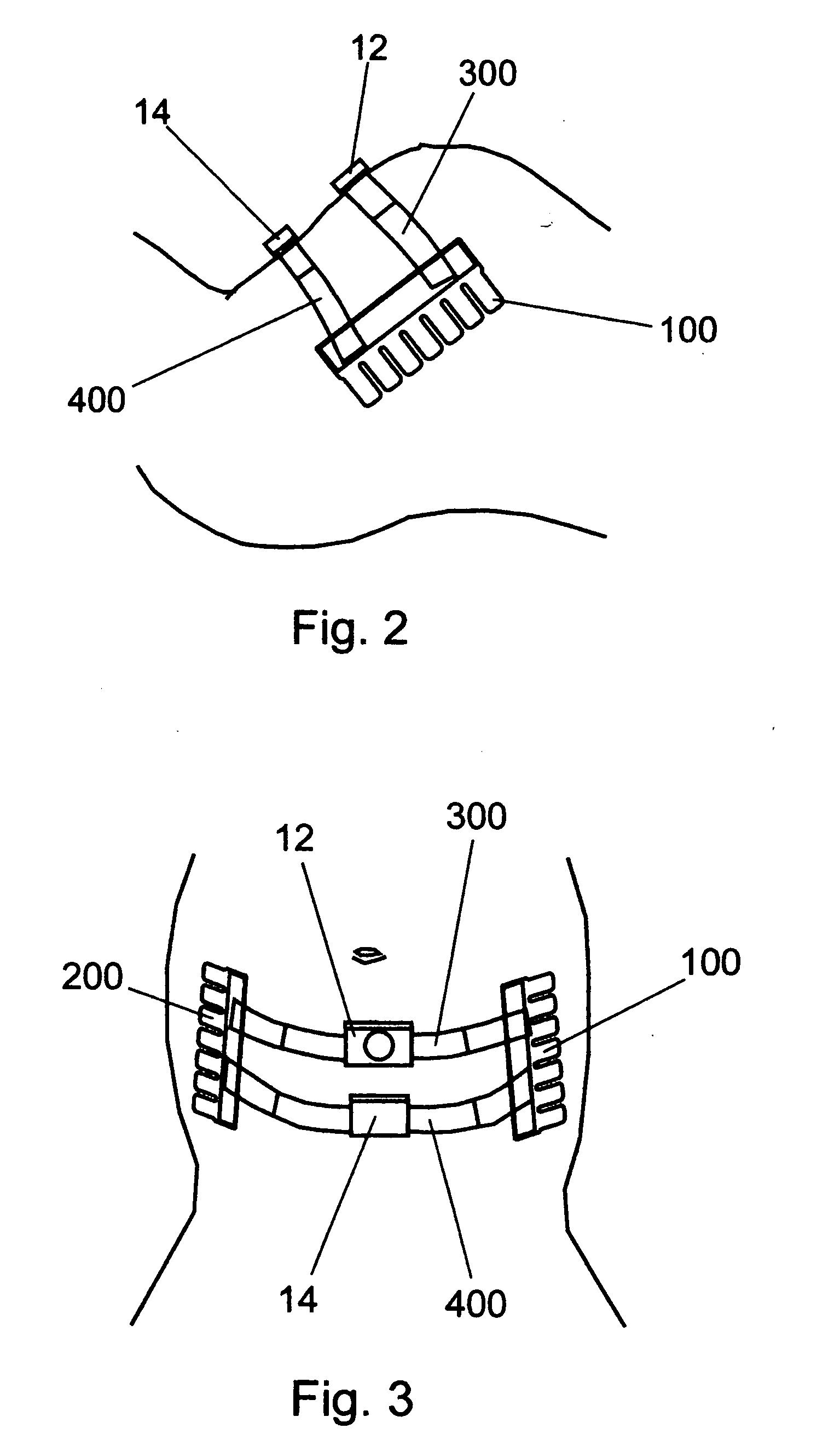 System, method, and kit for positioning a monitor transducer on a patient