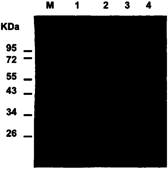 Application of kaempferol-3-O-rutinoside to preparation of medicine for treating PCSK9 (Proprotein convertase subtilisin/kexin type 9)-mediated disease