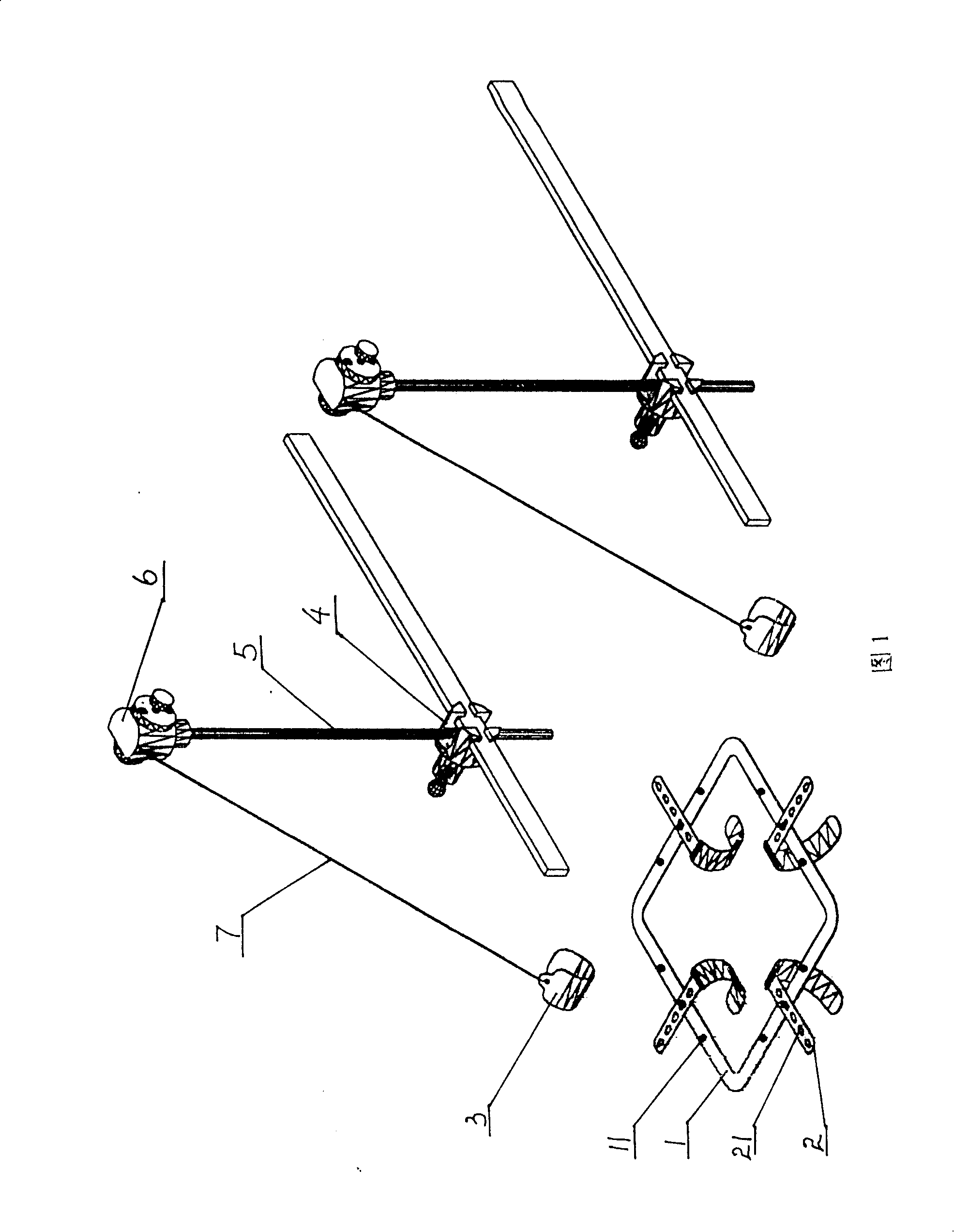 Stereo retractor for abdominal operation incision