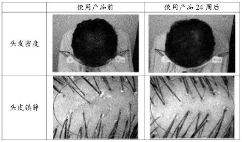 Cosmetic composition having effects of preventing and alleviating scalp inflammation and preventing hair loss