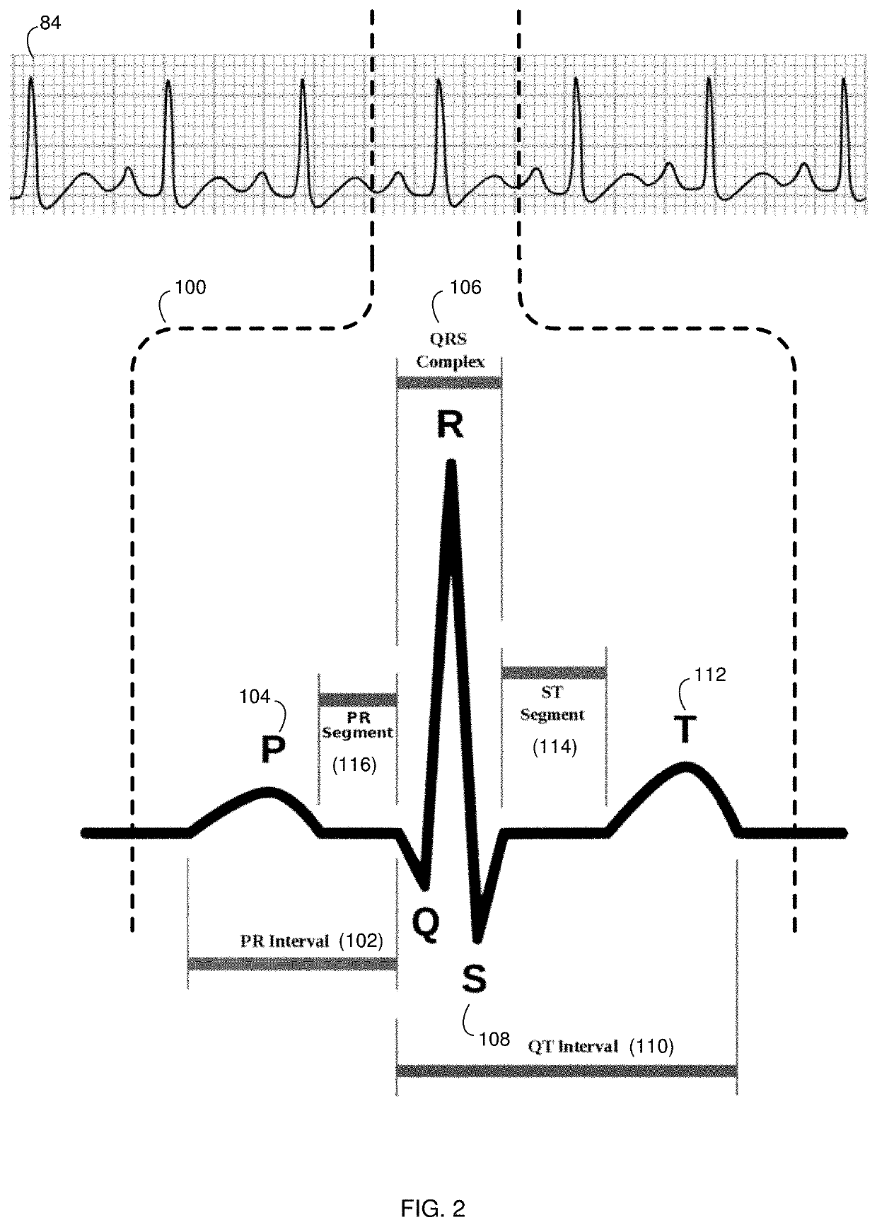 Heart signal waveform processing system and method