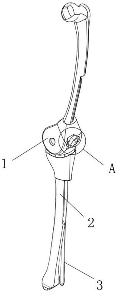 Anatomical patellofemoral joint prosthesis