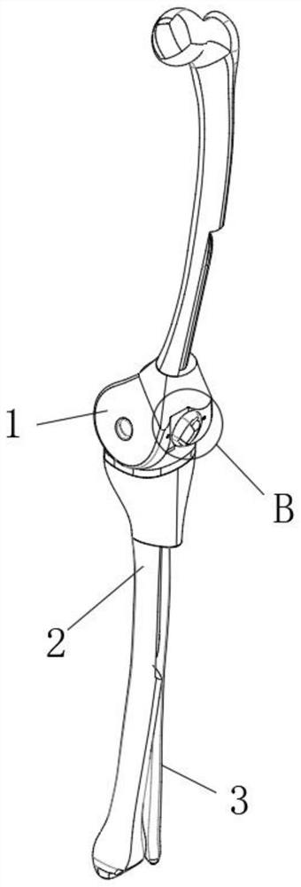 Anatomical patellofemoral joint prosthesis