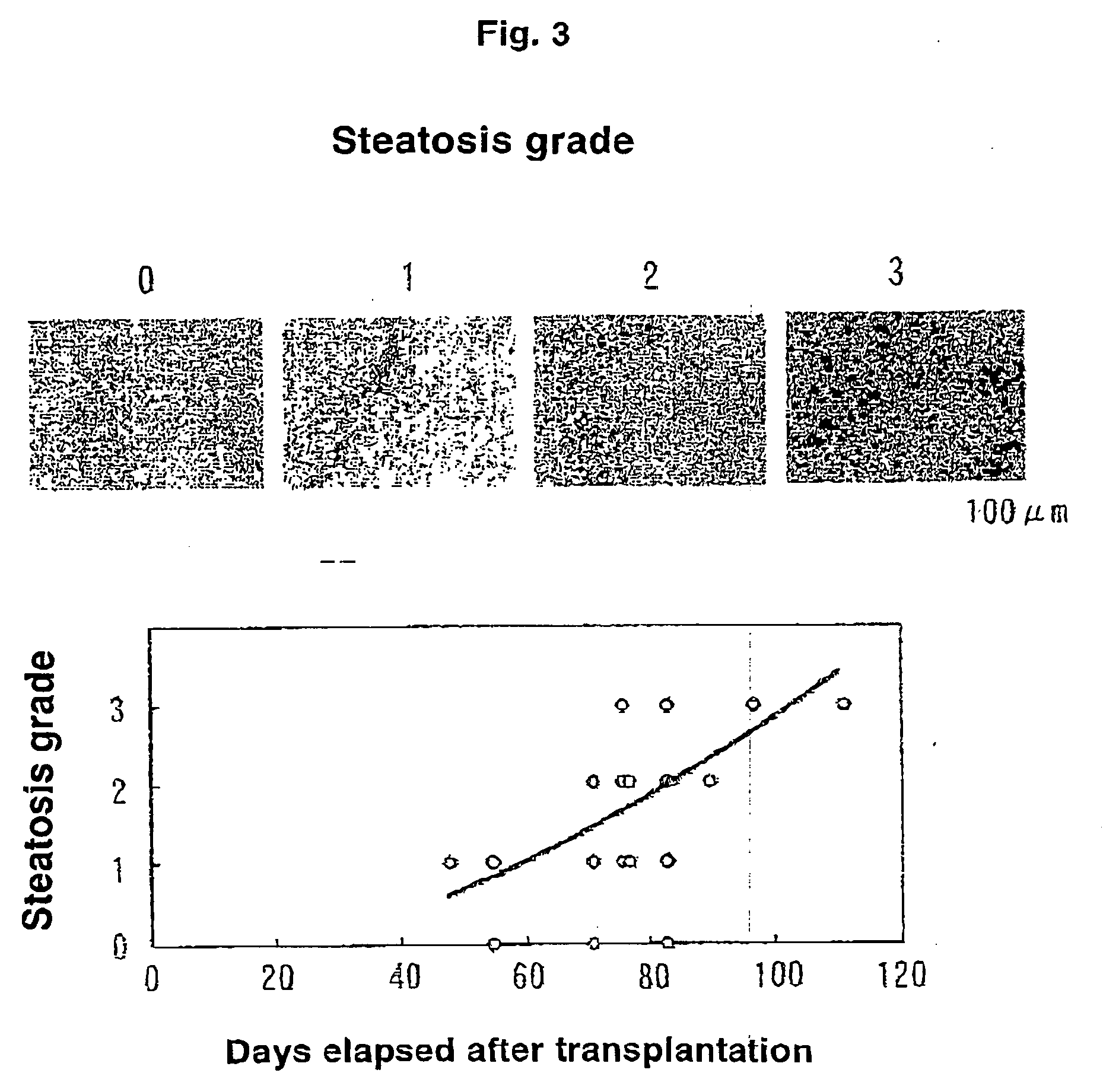 Method Of Treating Mouse Carrying Human Hepatocytes