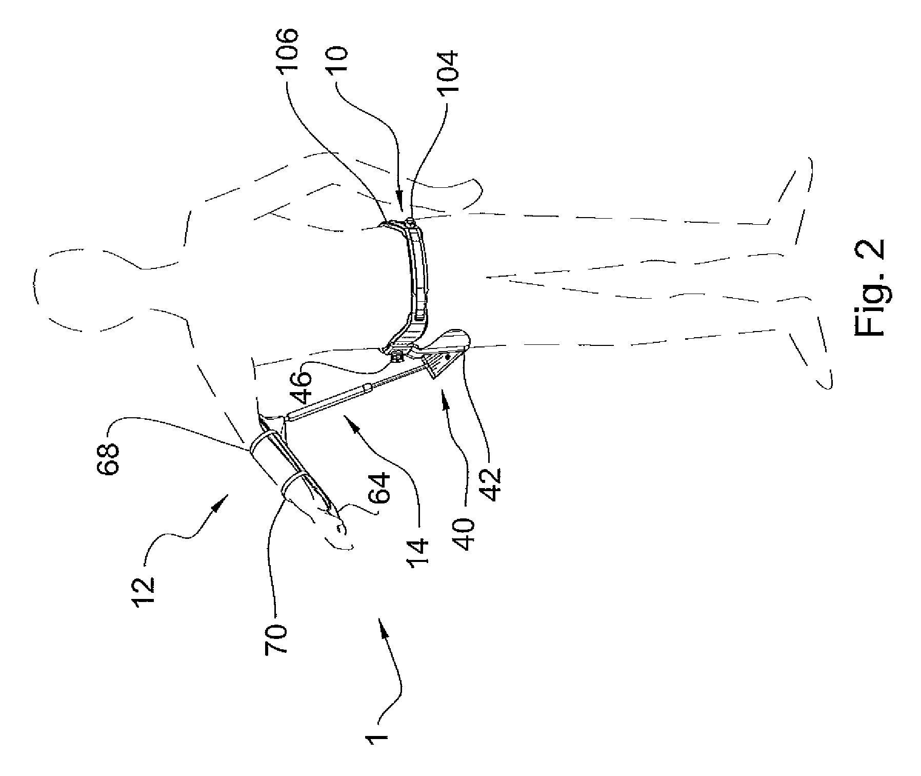 Dynamic shoulder orthosis with rehabilitating adduction