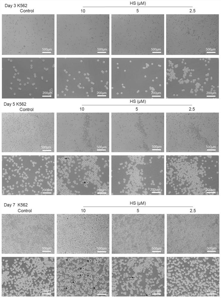 Application of hirsutine in medicine for treating thrombocytopenia