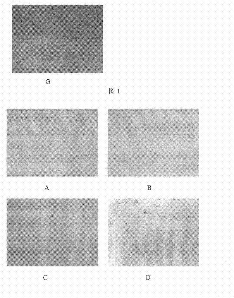Plant extract of the genus Zanthoxylum and its preparation method and use