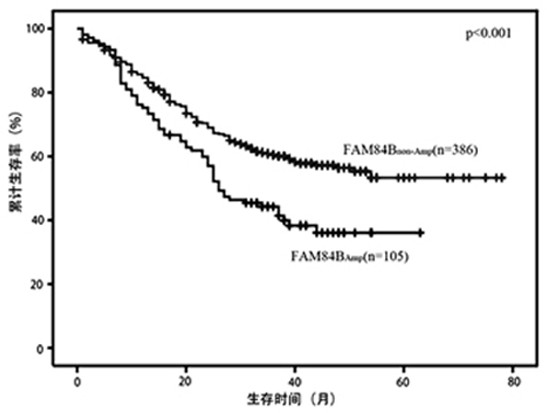 Application of FAM84B in preparation of reagent for prognosis evaluation of esophageal squamous cell carcinoma and in screening of drugs for targeted treatment of esophageal squamous cell carcinoma