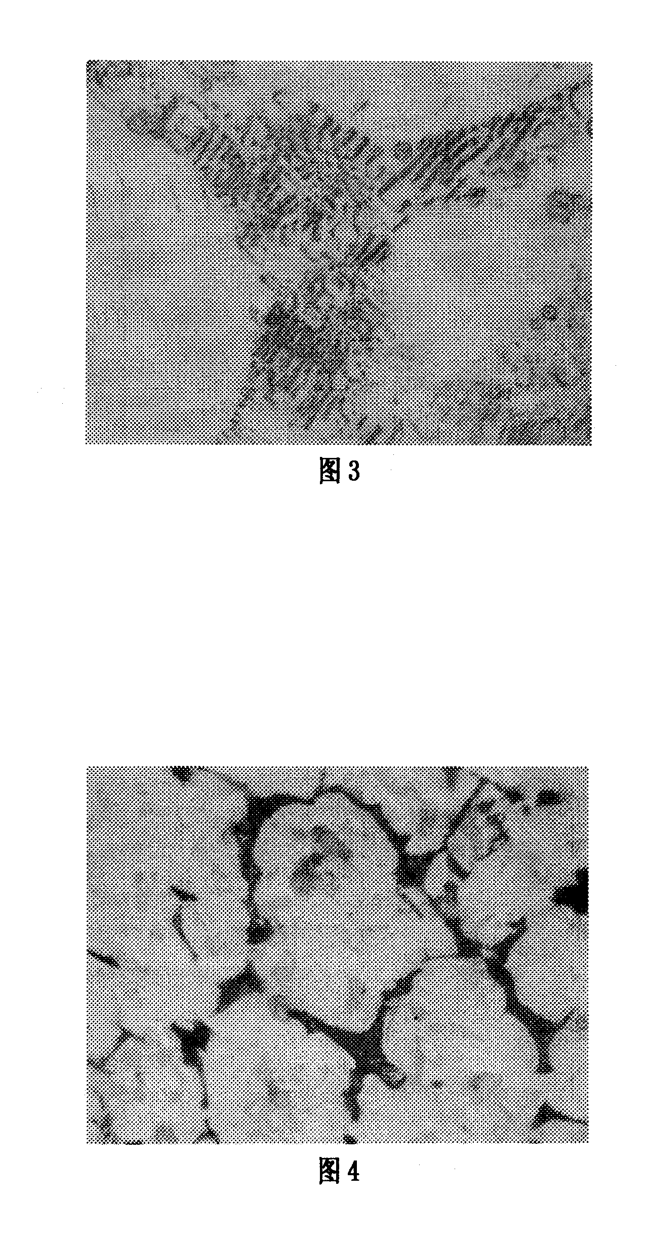 Method for synthesizing magnesium-silicon intermediate and preparation of high-magnesium aluminum alloy thereby