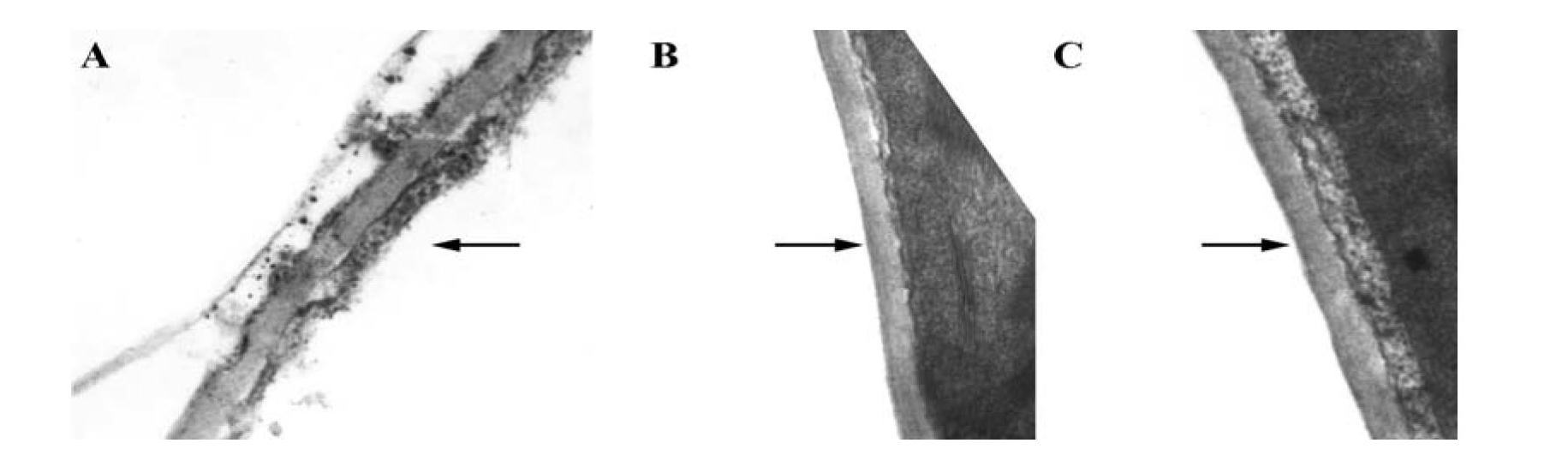 Polygalacturonase PCIPG21 from phytophora capsic, and coding gene and application thereof